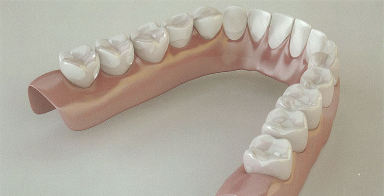Acrylic Dentures in Stockport